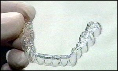 ClearAligner Consultation Approval