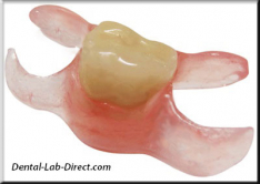 Additional Tooth for Temporary Bridge/Partial Denture